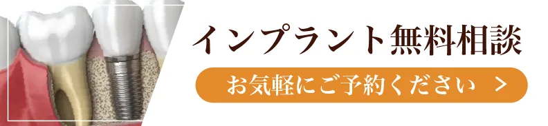 インプラント無料相談 お気軽にご相談ください