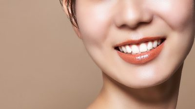 せたがや歯科室｜ブログ｜ホワイトニングの種類とメリット・デメリット｜歯を見せて笑う女性の画像