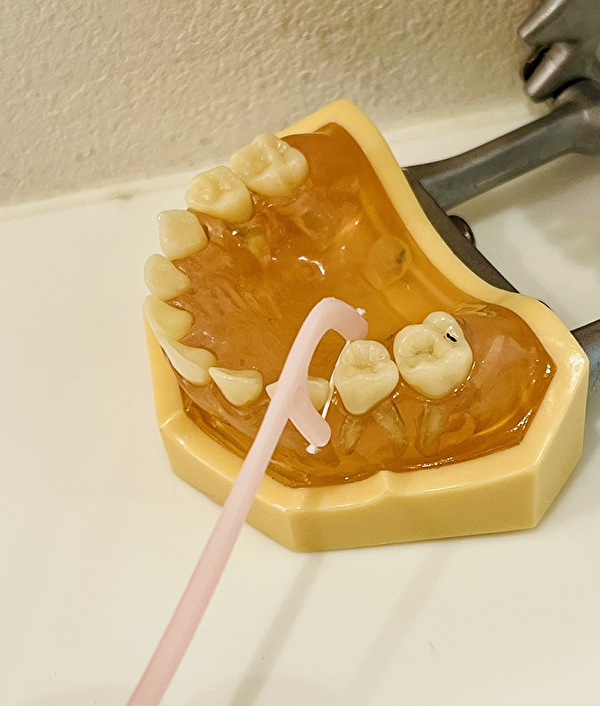 せたがや歯科室｜ブログ｜「補助清掃用具」って何？デンタルフロス・歯間ブラシ・ワンタフトブラシについて解説｜F字型デンタルフロスの画像