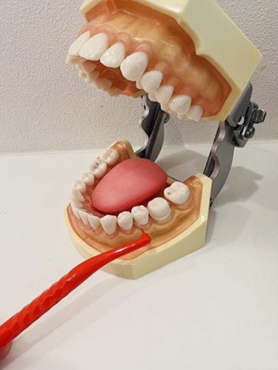 せたがや歯科室｜ブログ｜「補助清掃用具」って何？デンタルフロス・歯間ブラシ・ワンタフトブラシについて解説｜ワンタフトブラシを使用した画像