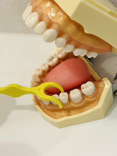 せたがや歯科室｜ブログ｜「補助清掃用具」って何？デンタルフロス・歯間ブラシ・ワンタフトブラシについて解説｜Y字型デンタルフロスを使用した画像